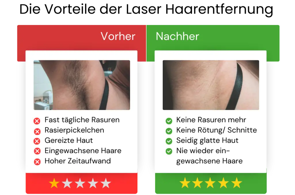 Vorteile der Laser Haarentfernung (1)